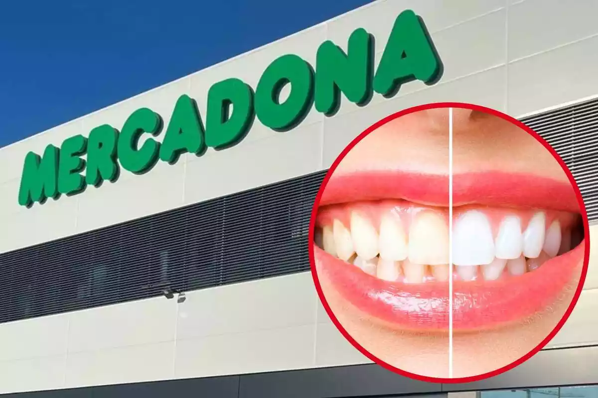 Blanqueamiento dental de Mercadona