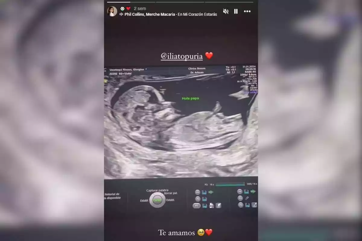 Fotomontaje de la captura de una ecografía del embarazo de Topuria y Giorgina Uzcategui Fotomontaje de la captura de una ecografía del embarazo de Topuria y Giorgina Uzcategui