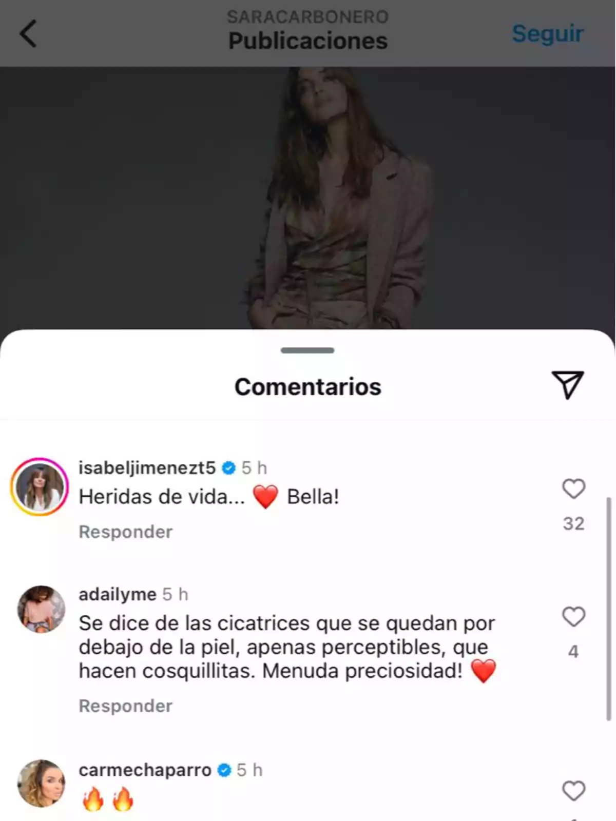 Sara Carbonero posa con un atuendo elegante en una publicación de Instagram. En los comentarios, Isabel Jiménez elogia la imagen con un mensaje como Sara Carbonero posa con un atuendo elegante en una publicación de Instagram. En los comentarios, Isabel Jiménez elogia la imagen con un mensaje como