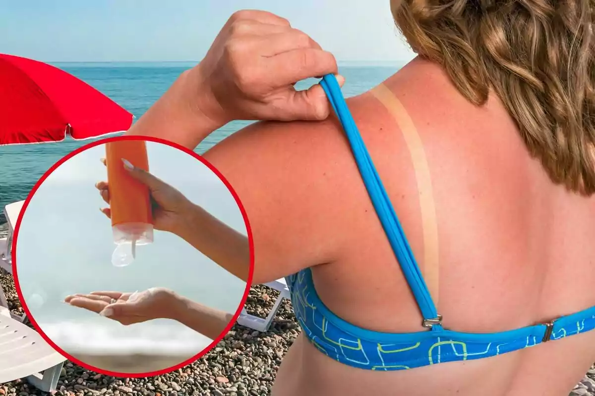Una mujer enseña la quemadura del sol en la playa, y en el círculo, un bote de protección solar