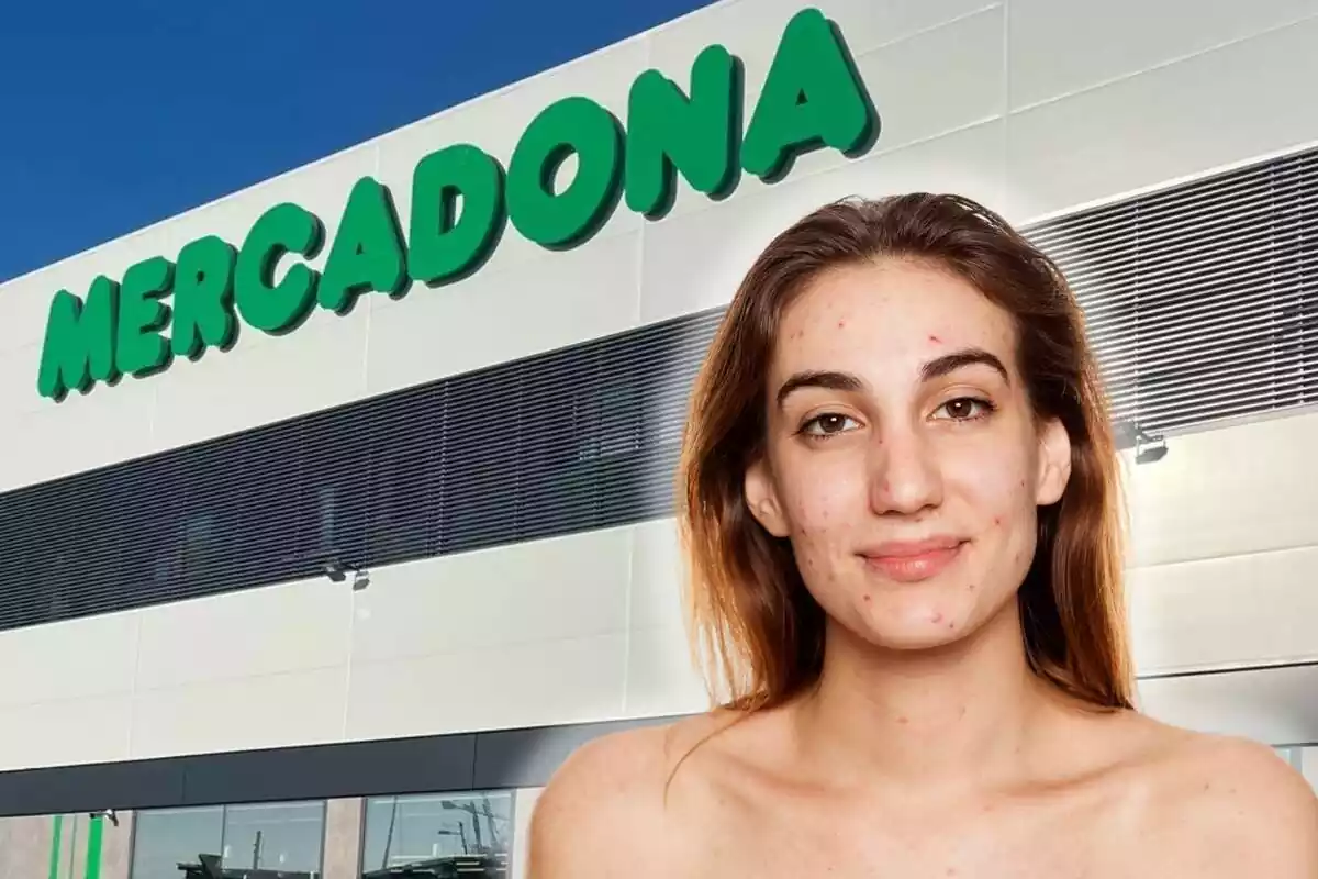 Persona con acné y de fondo un supermercado de Mercadona